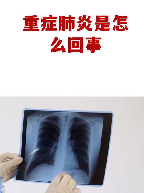 山西忻州新增5例重症，从境外抵四川成都都江堰(山西忻州有没有新型冠状病毒)