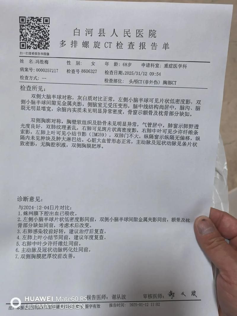 贵州黔西南布依族苗族自治州兴仁现有死亡病例12例_黔西兴仁乡