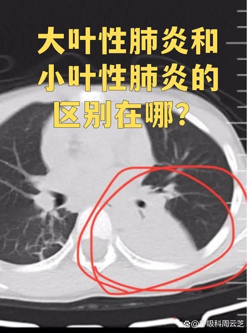 重庆巫山县新增11例无症状感染者及10例无症状/巫山有没有新型肺炎